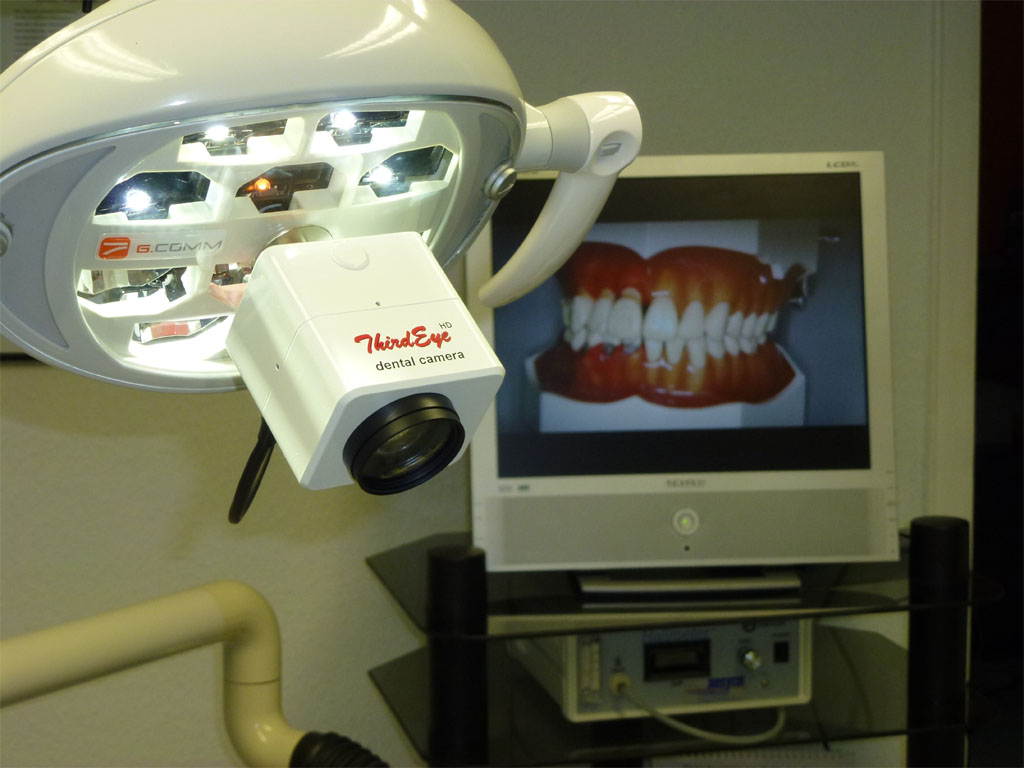 ThirdEye dental cameras can be mounted on any dental light