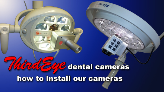 thirdeye dental cameras installation video
